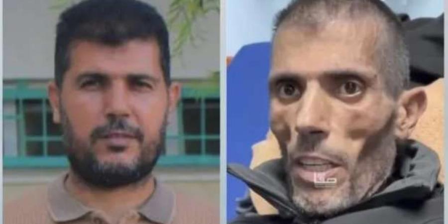 «بقى هيكل عظمي».. صور لفلسطيني قبل وبعد الإفراج عنه من سجون إسرائيل: تعذيب لا يوصف - ميديا سبورت